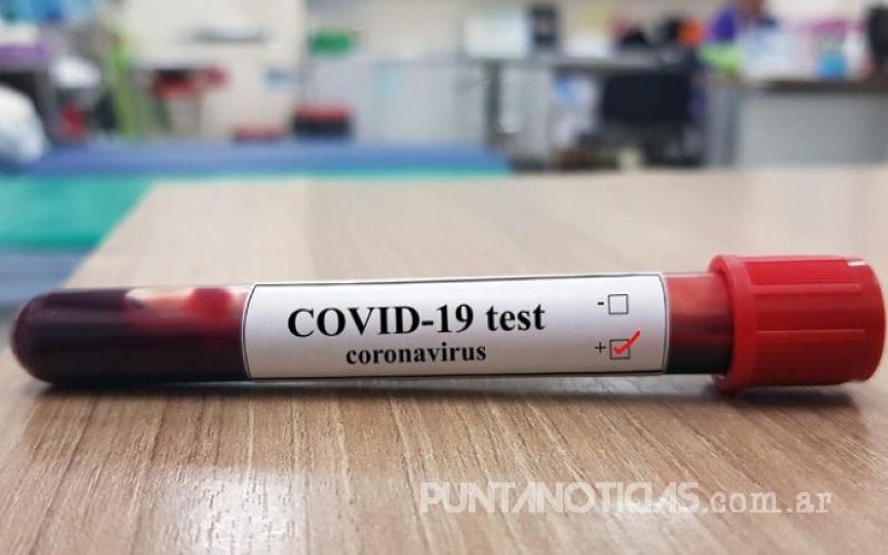 Se registró un nuevo caso positivo de coronavirus