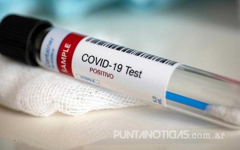 COVID-19: se registraron 29 casos positivos y 10 recuperados