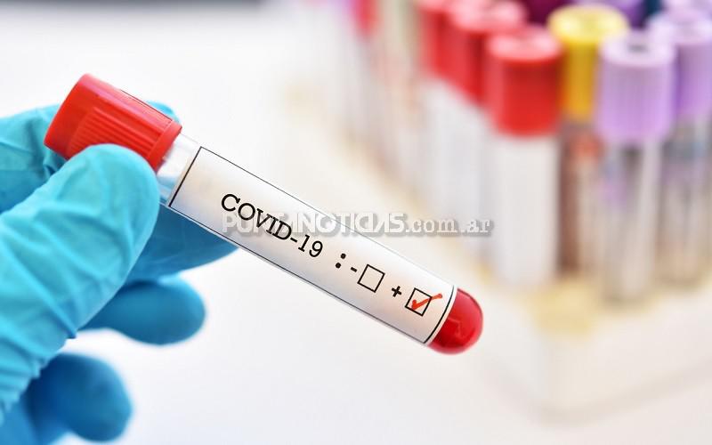 Hubo 42.227 contagios de coronavirus en el país, un 20% menos que la semana pasada 